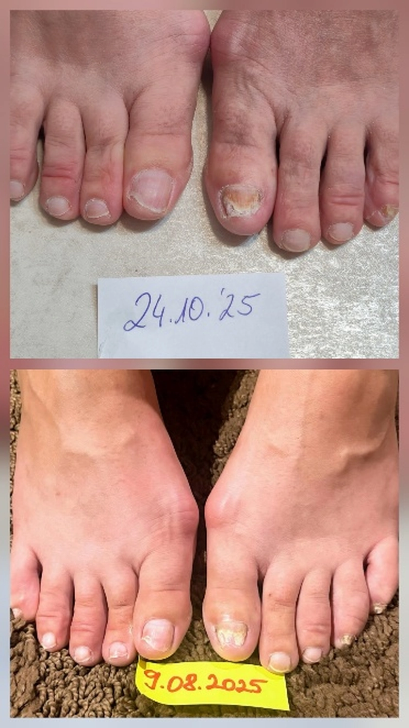 Fusszinierend - Fußpflege -Diese Kundin (50J) 