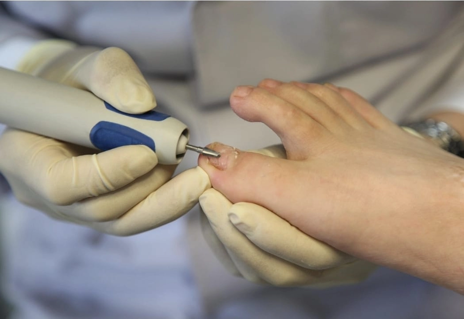 Fusszinierend - Fußpflege - Polyneuropathie Füße pflegen Ursachen und Tipps